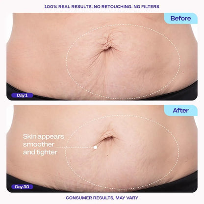 GOPURE Belly Cream 125ml